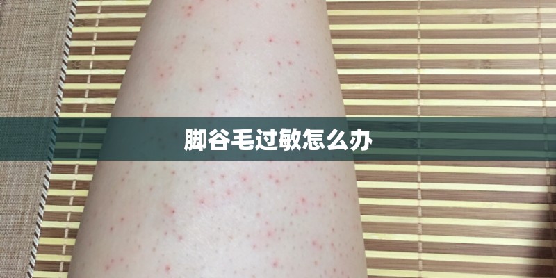 脚谷毛过敏怎么办