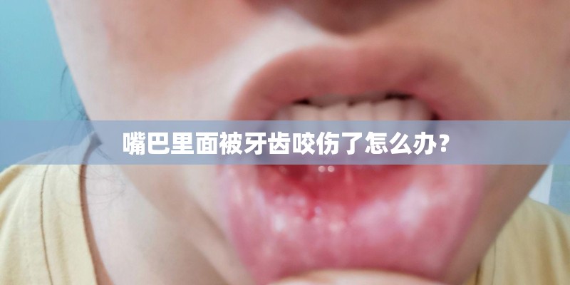 嘴巴里面被牙齿咬伤了怎么办？